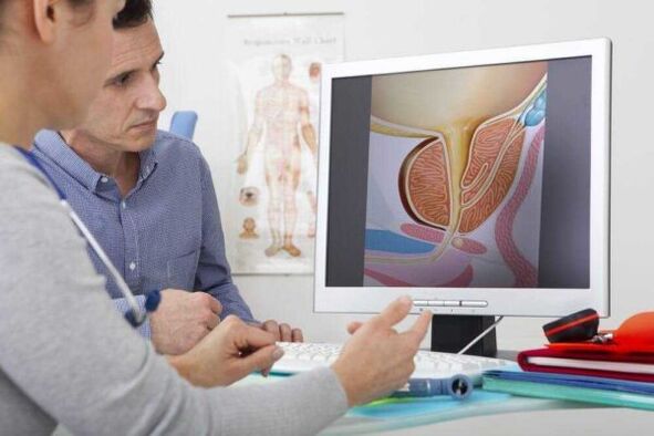 The doctor consults the patient on the issue of prostatitis