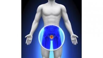 Prostatitis in men