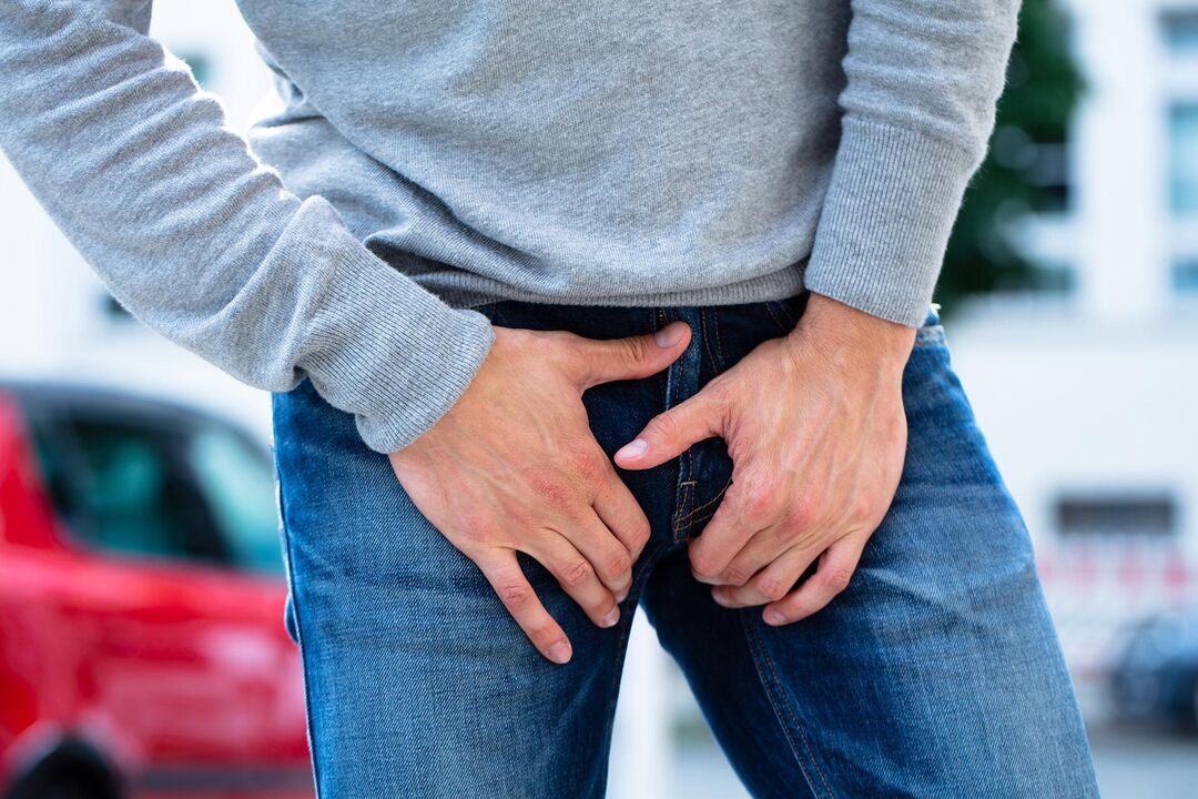 Groin pain in a man with calculous prostatitis